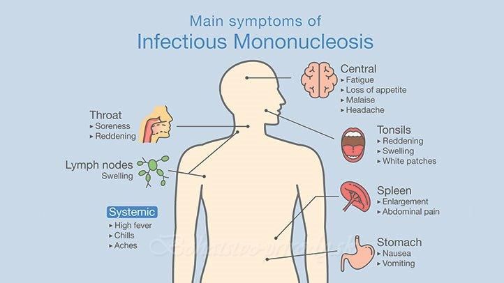 symptoms of mono in teens